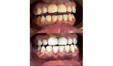 استشارات للأسنان اعتني بأسنانك